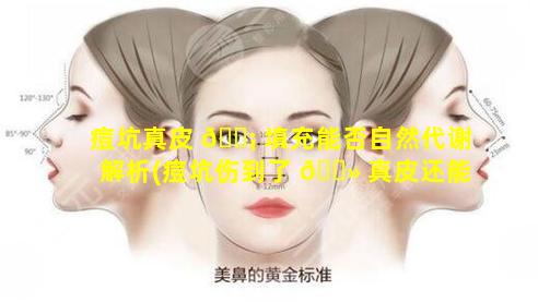 痘坑真皮 🐡 填充能否自然代谢解析(痘坑伤到了 🌻 真皮还能恢复吗)